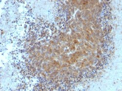Bax Antibody (BAX/962), Novus Biologicals 0.2mg; Unlabeled:Antibodies,